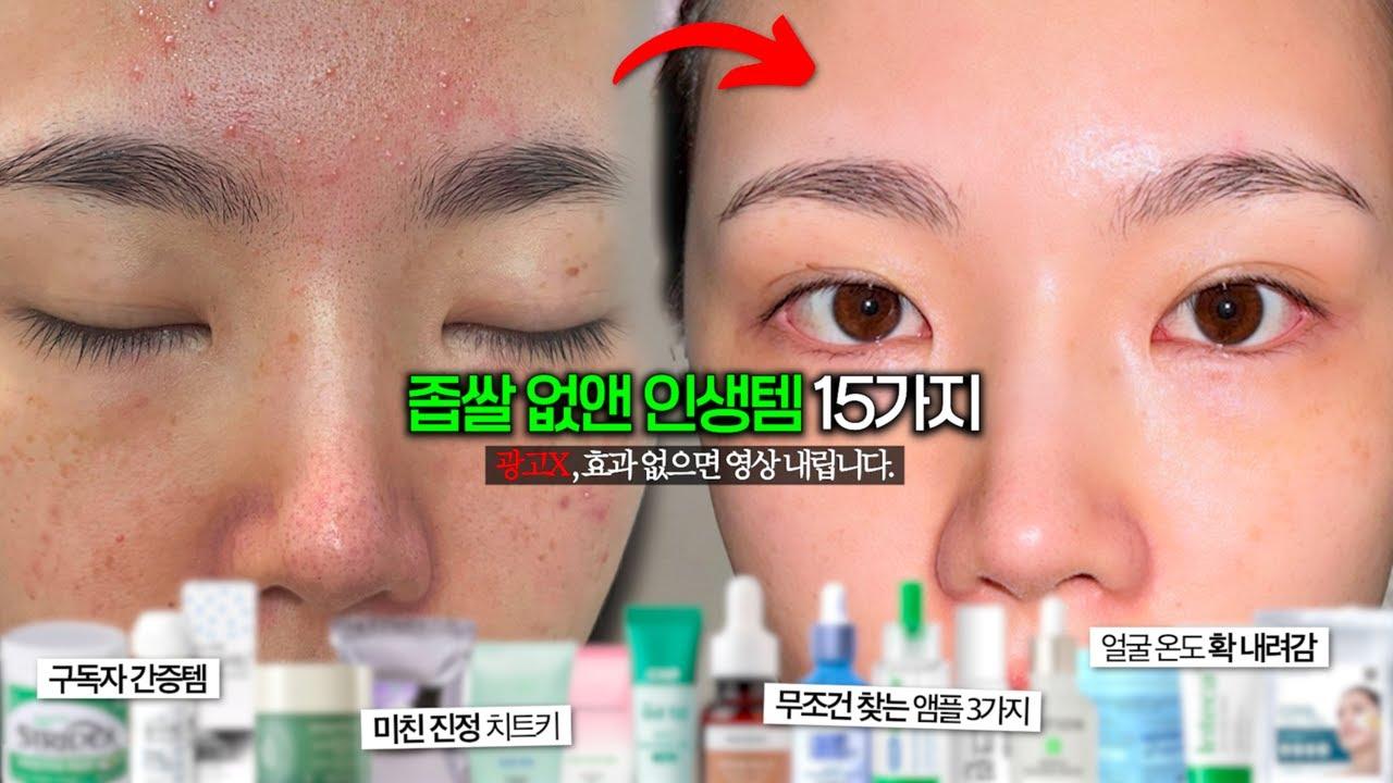 좁쌀 없앤 한별두별의 모델링팩 인생템