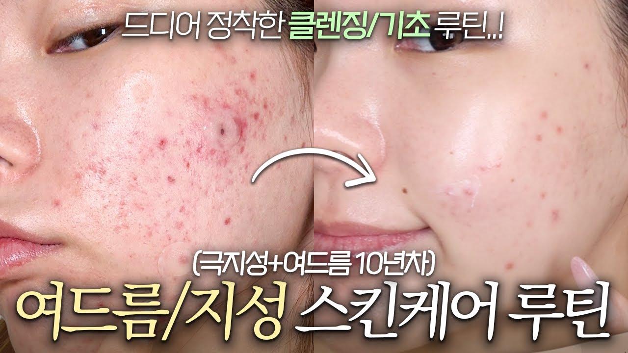 극지성 피지 녹이는 딥클렌징 루틴