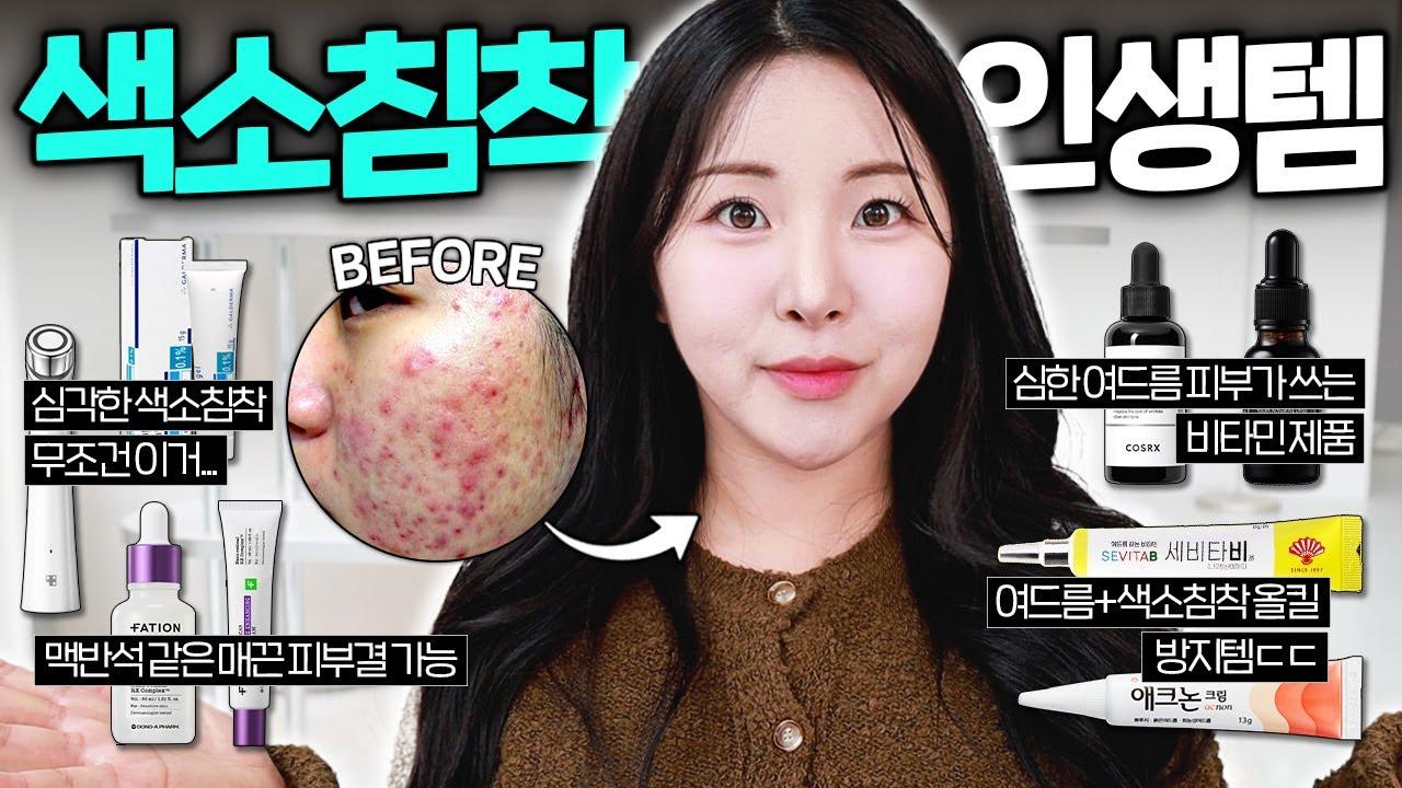 여드름 집중 진정 스팟케어 루틴