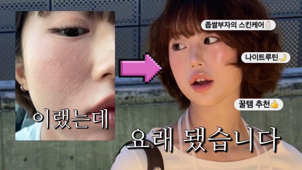 연고 먼저! 좁쌀 집중 케어 나이트 루틴