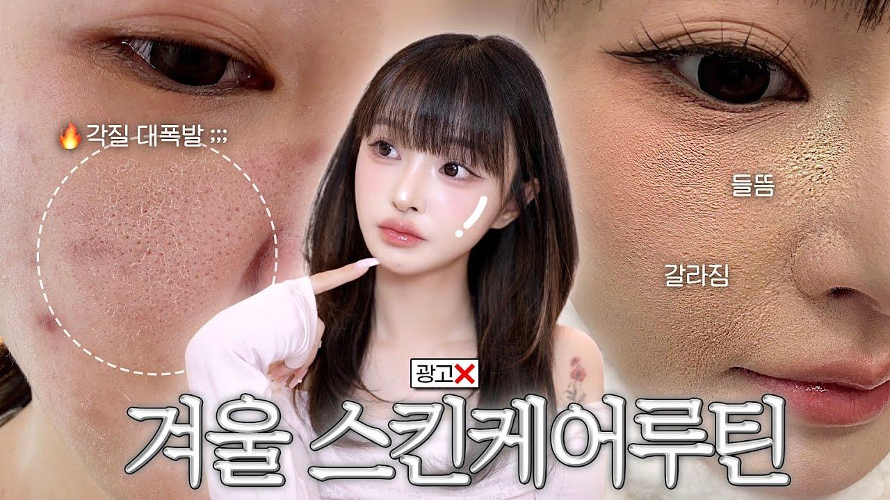 안다의 악건성 피부 구원 겨울 스킨케어 루틴